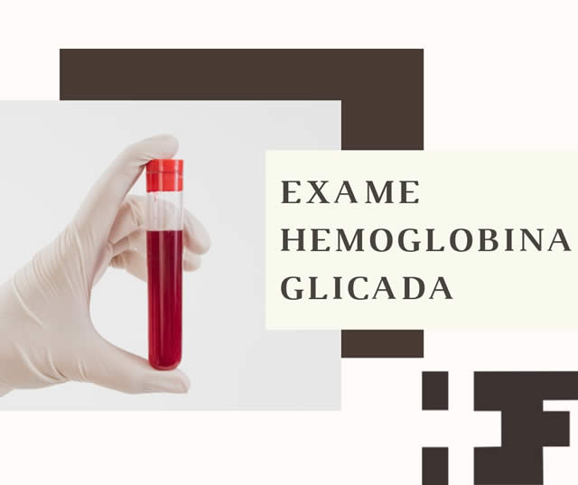 Exame Hemoglobina Glicada