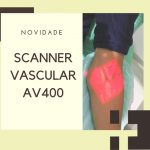 Scanner Vascular